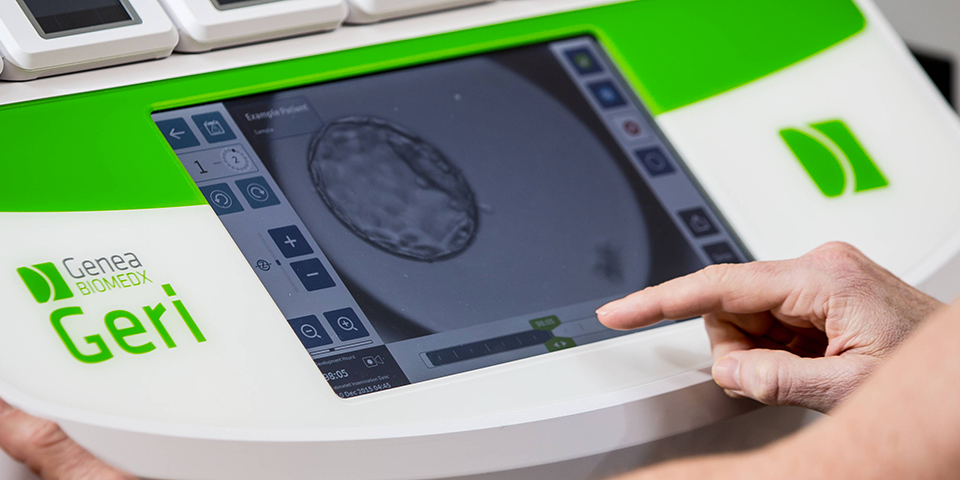 Blastocyst Stage Culture