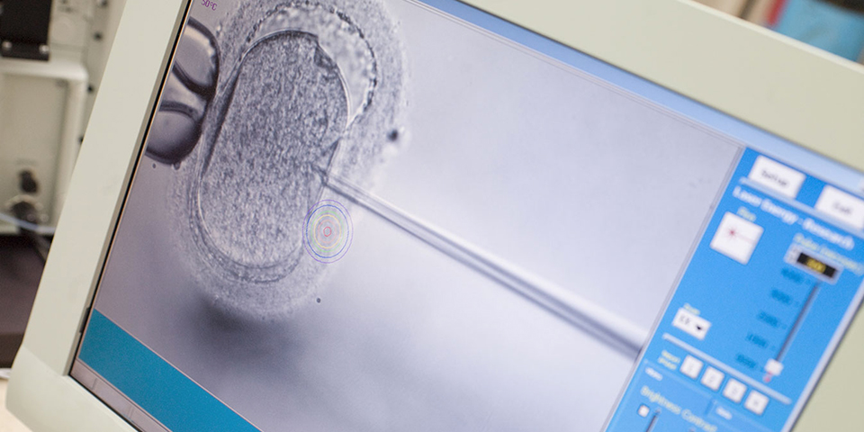 ICSI, Intracytoplasmic Sperm Injection